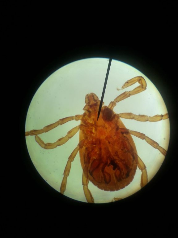 What to know before visiting the woods: My experience with a nymph tick