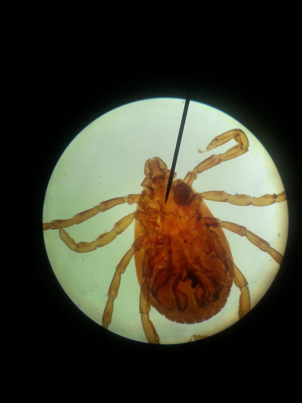 thick under microscope